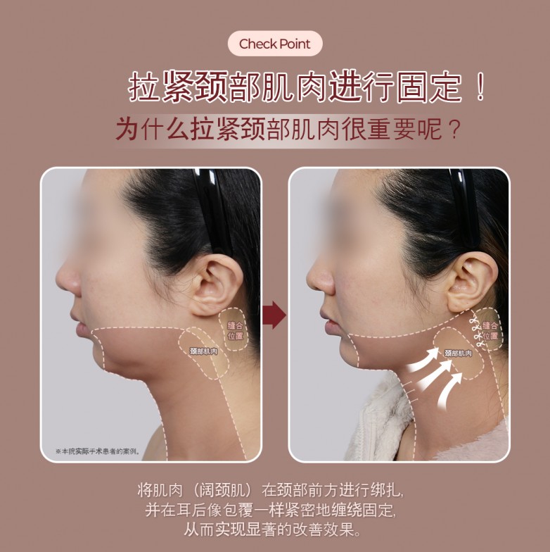 0bc38cb7a1db39065a97233b3347e9e.jpg